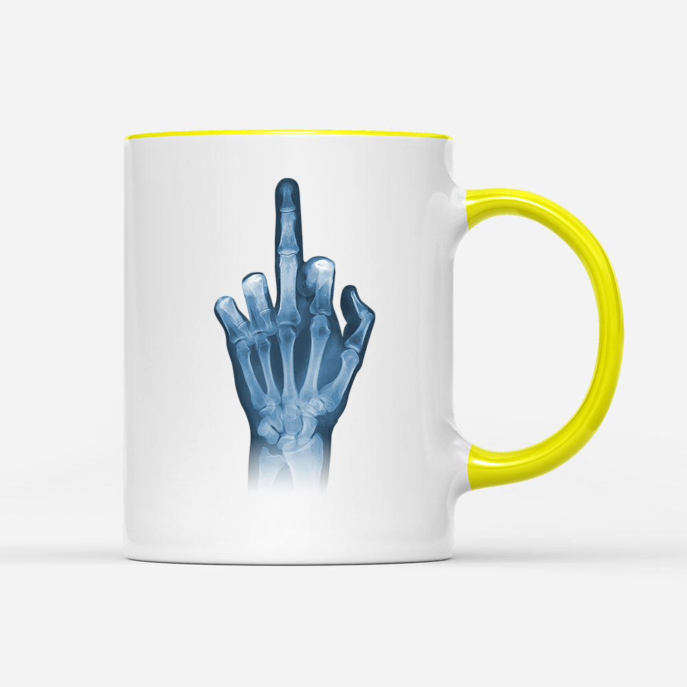 Tasse Röntgen Mittelfinger