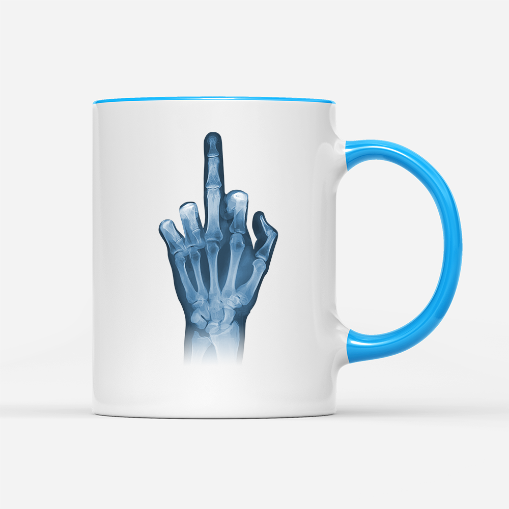 Tasse Röntgen Mittelfinger
