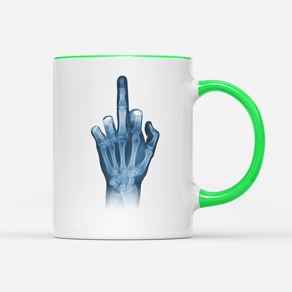 Tasse Röntgen Mittelfinger