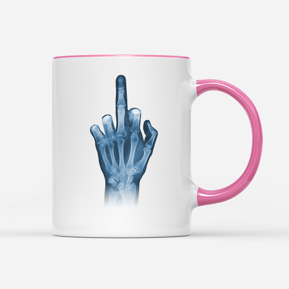 Tasse Röntgen Mittelfinger