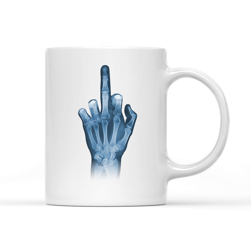 Tasse Röntgen Mittelfinger